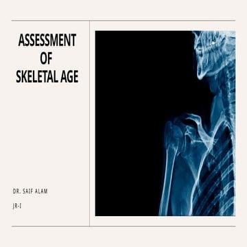 Assessment of skeletal age in Orthodontics