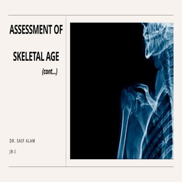 Assessment of skeletal age in Orthodontics (2).pptx