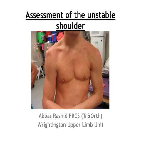 Assessment of the unstable shoulder