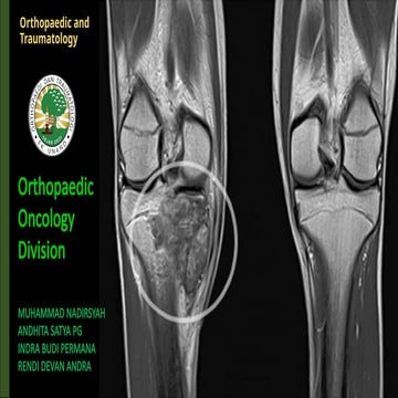 Comprehensive Case Study on Limb Salvage Surgery for Metastatic Bone ...