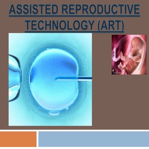 Assisted reproductive technology (ART)