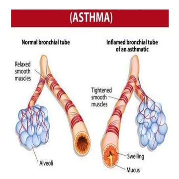 ASTHMA_012154.pptx