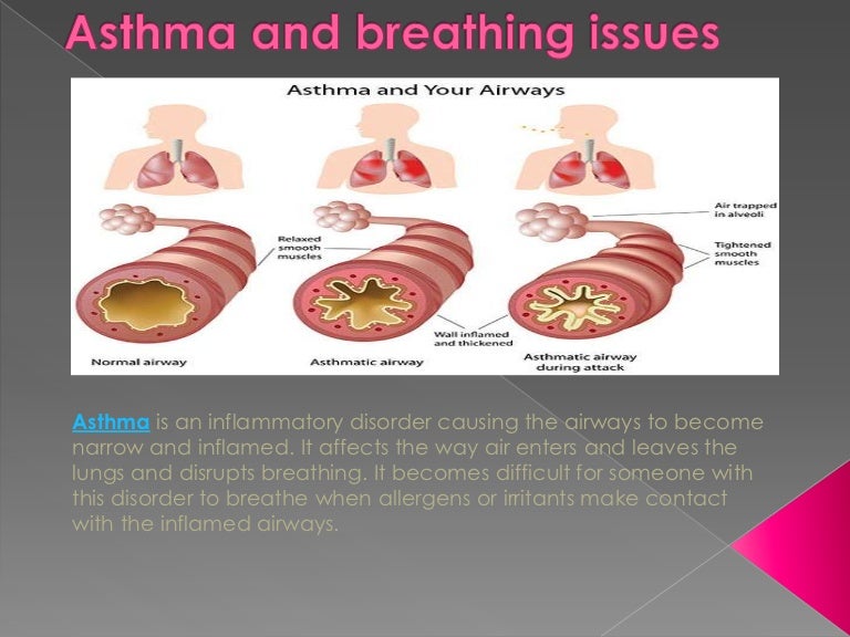 Asthma and breathing issues