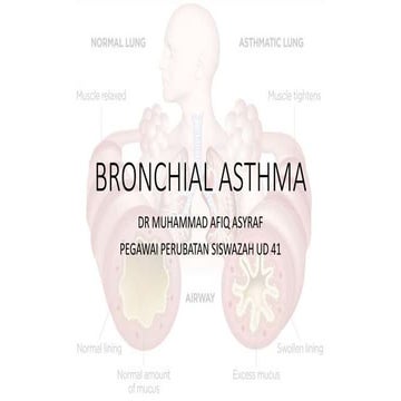 asthma  .pptx