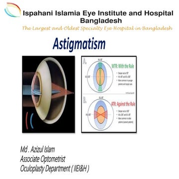 Astigmatism ppt