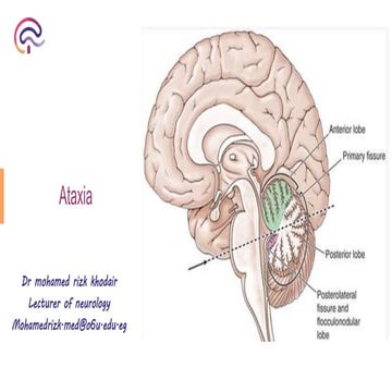ataxia 