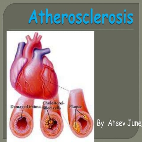 atherosclerosis