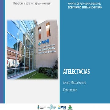 diagnostico imagenologico de las atelectacias