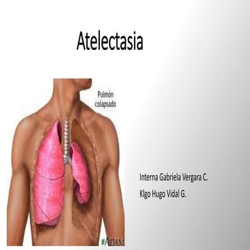 Atelectasias