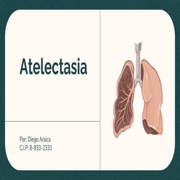 Atelectasia.pptx