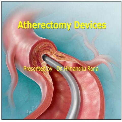 Atherectomy devices