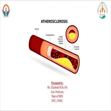 Atherosclerosis pathophysiology | PPTX