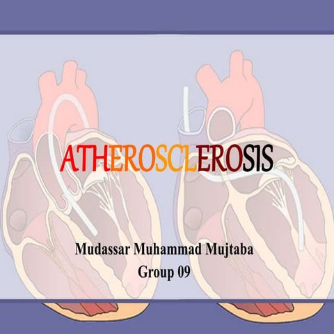 Atherosclerosis. Mudassar Muhammad Mujtaba G09.pptx