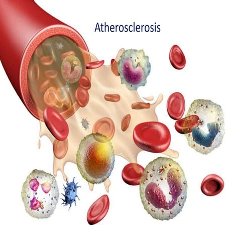 Atherosclerosis creative diagnostic 