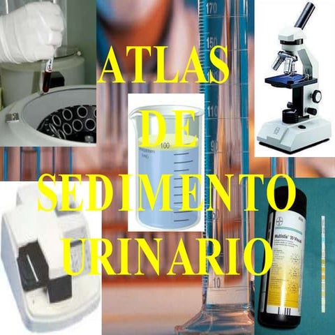Atlas de sedimento urinario
