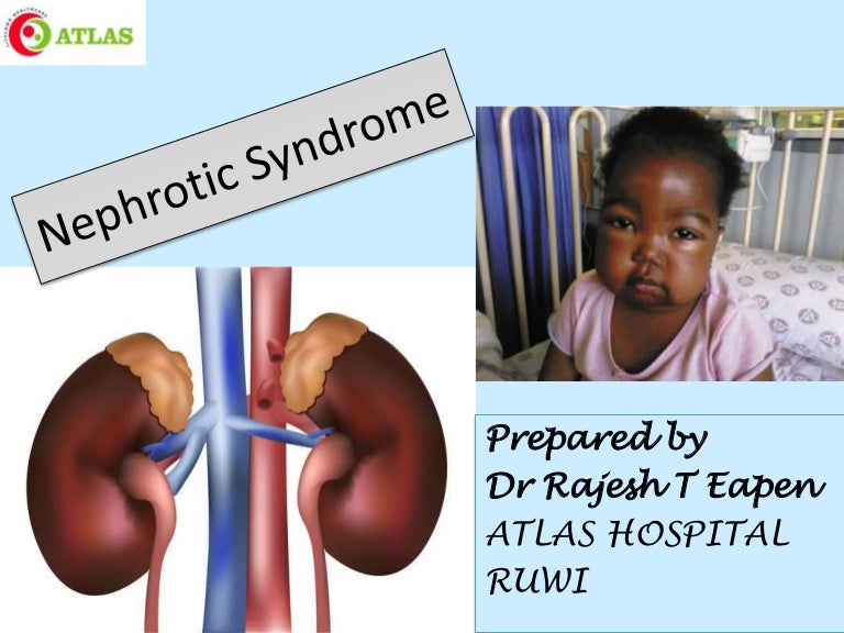 Nephrotic Syndrome