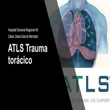 Atls trauma torax | PPTX