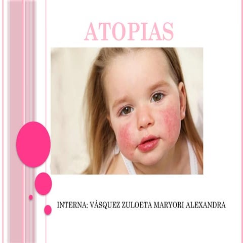 atopias-DERMATOLOGÍA- MEDICINA HUMANA.pptx