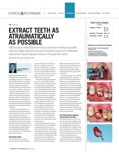 Vonlay; A paradigm shift in post endodontic restoration: A case report ...