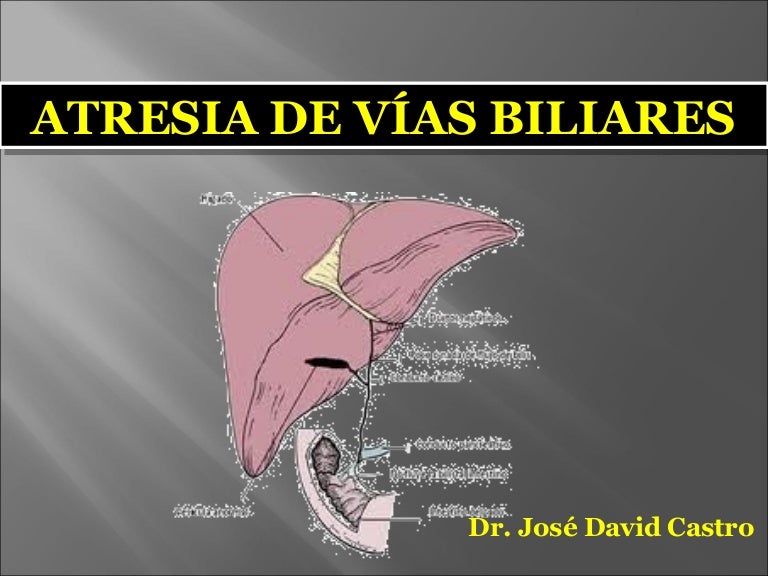 atresia del tracto biliar agenesia del feto de la vesícula biliar