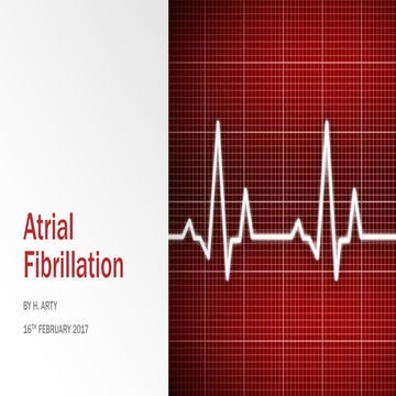 Atrial fibrillation