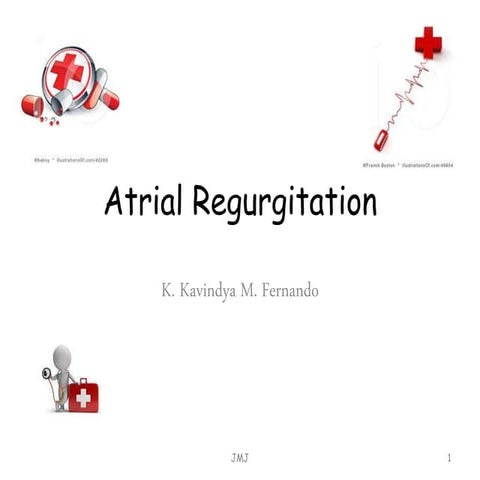 Atrial regurgitation
