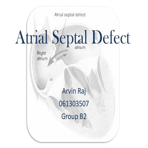 Atrial septal defect | PPT