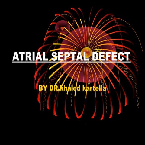ATRIAL SEPTAL DEFECT (ASD) | PPT