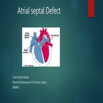 Atrial septal defect .by shanta