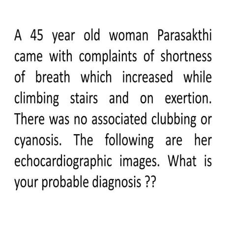 Atrial septal defect Echocardiography