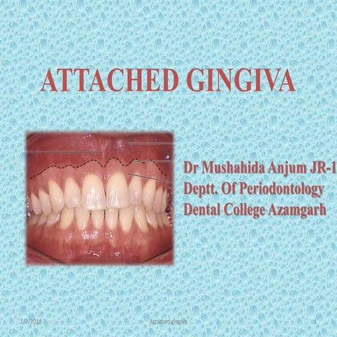 ATTACHED GINGIVA