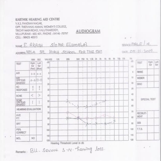 Audiogram 7 children | PDF