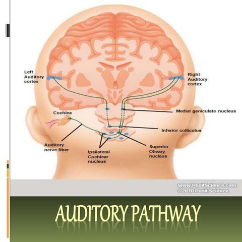 Auditory pathway