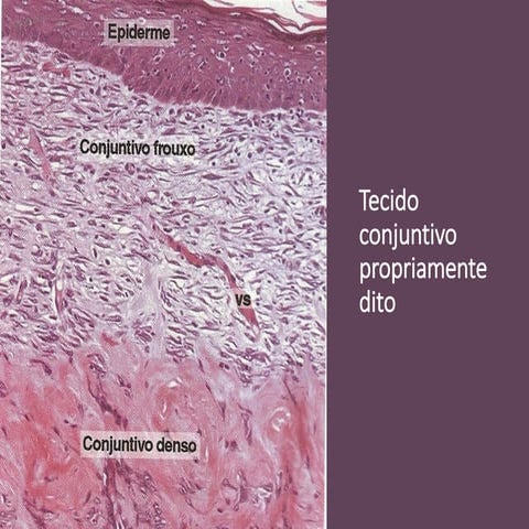 aula 3 - tecido conjuntivo - material de apoio.pdf