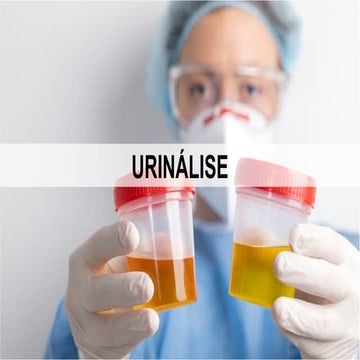 Aula de Urinálise: exames físico-químicos e sedimentoscopia