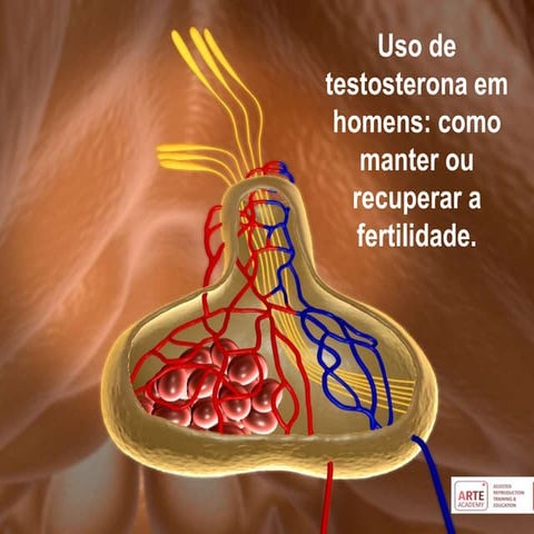 Testosterona em homens jovens: armadilhas, como recuperar a fertilidade ...
