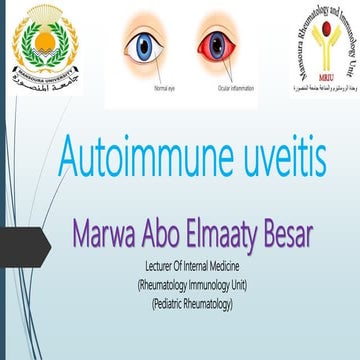 Autoimmue uveitis