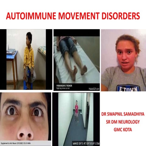 Autoimmune movement disorders