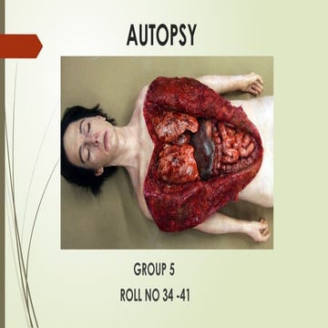AUTOPSY forenic medicine ppt fmtv 2.pptx