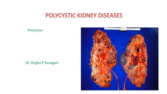Polycystic Kidney Disease (PCKD).pptx... | PPTX