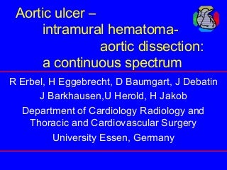 Aortic ulcer intramural hematoma aortic dissection