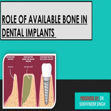 Available Bone and Dental Implant Treatment Plans.pptx