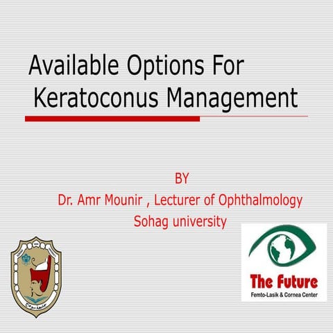 Available options for keratoconus management
