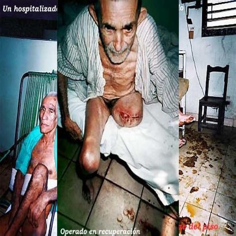 Avances medicina cubana