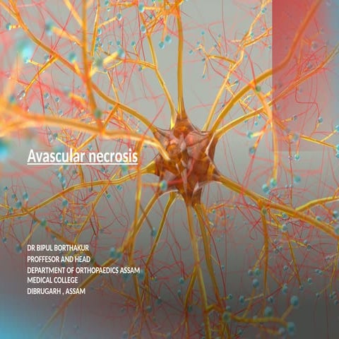 Avascular Necrosis Presentation.pptx ppt