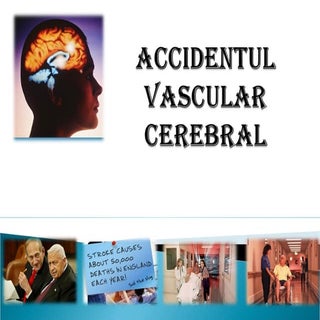 Accidentul Vascular Cerebral