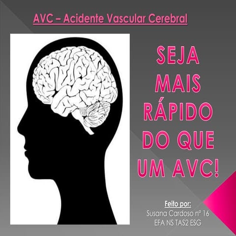 Aula 4 - Acidente Vascular Cerebral .pptx