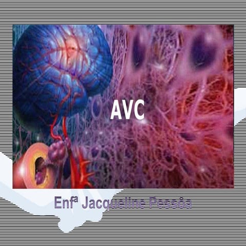 Aula 4 - Acidente Vascular Cerebral .pptx