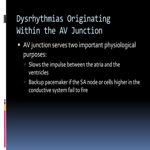 Junctional Rhythms - BMH/Tele | PPT