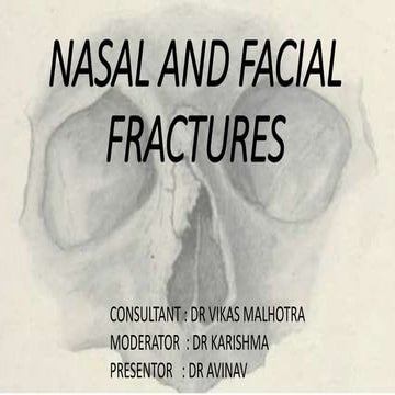 Facial Fractures